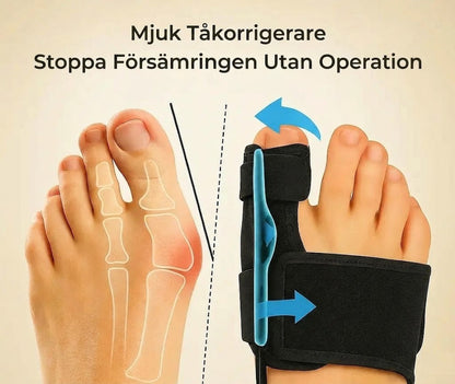 Norvio | Mjuk tåkorrigerare (vänster + höger) – och hur du stoppar det utan operation